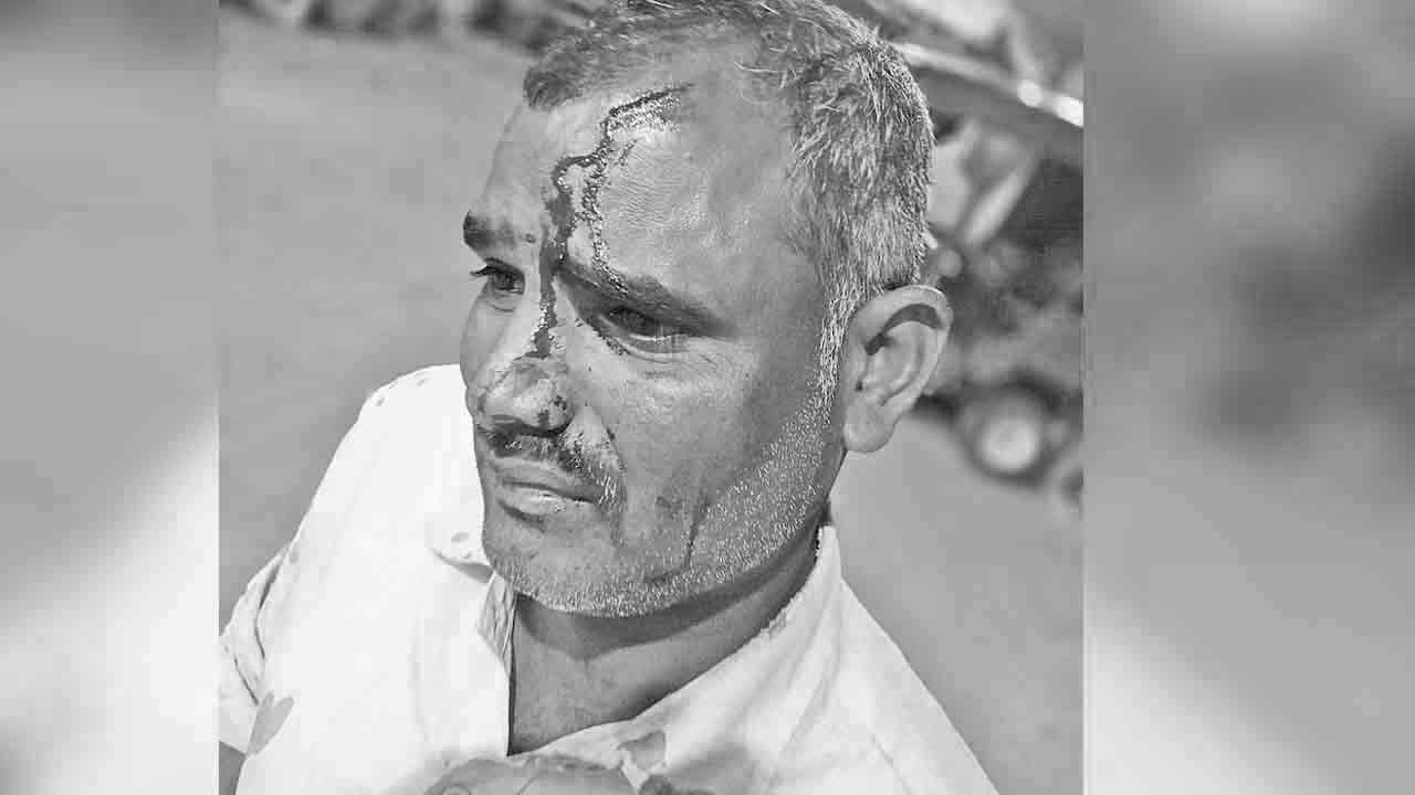 బీఆర్‌ఎస్‌ కార్యకర్తలపై కాంగ్రెస్‌ దౌర్జన్యం