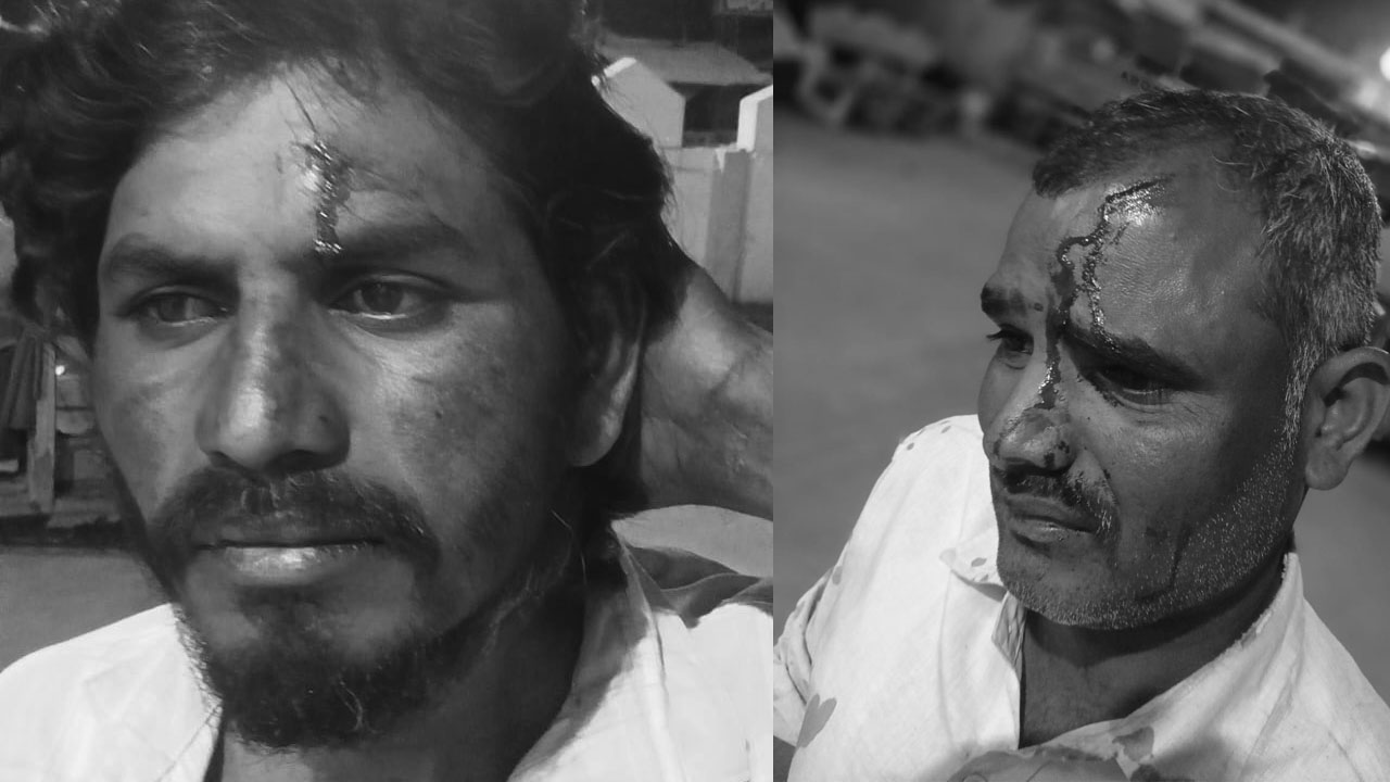 Congress Attack | కాంగ్రెస్‌ నాయకుల దాడిలో బీఆర్‌ఎస్‌ కార్యకర్తలకు గాయాలు