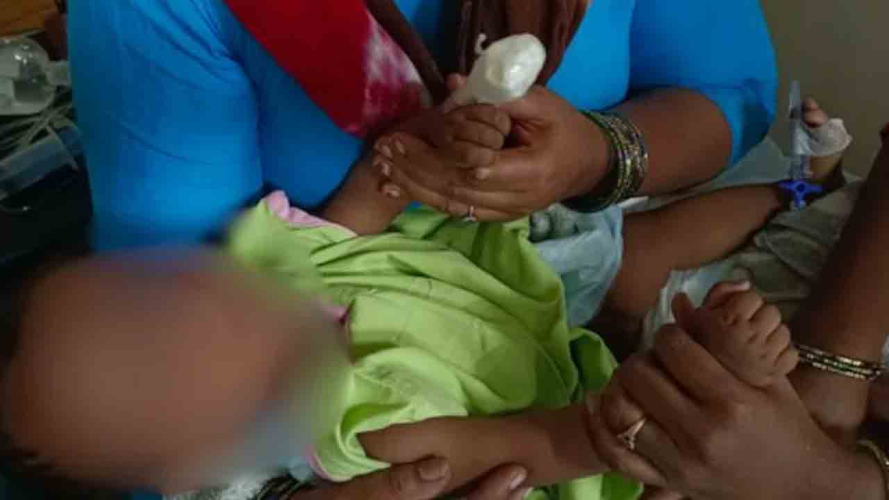 Baby Loses Finger | ఐవీ డ్రిప్‌ తొలగిస్తుండగా నర్సు నిర్లక్ష్యం.. చిన్నారి వేలు కట్‌