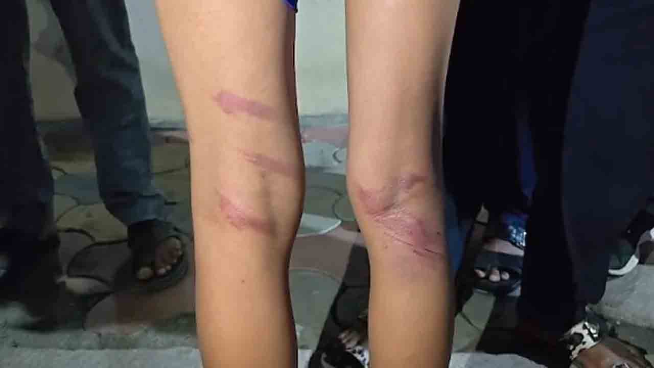 Teacher Assaults 30 Students | వంగిన బైక్‌ నంబర్‌ ప్లేట్‌.. 30 మంది విద్యార్థులను చితకబాదిన టీచర్‌