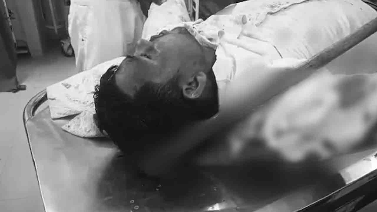 Man with axe in head | పెళ్లి వేడుకలో ఒక వ్యక్తిపై దాడి.. తలలో దిగిన గొడ్డలితో   హాస్పిటల్‌కు