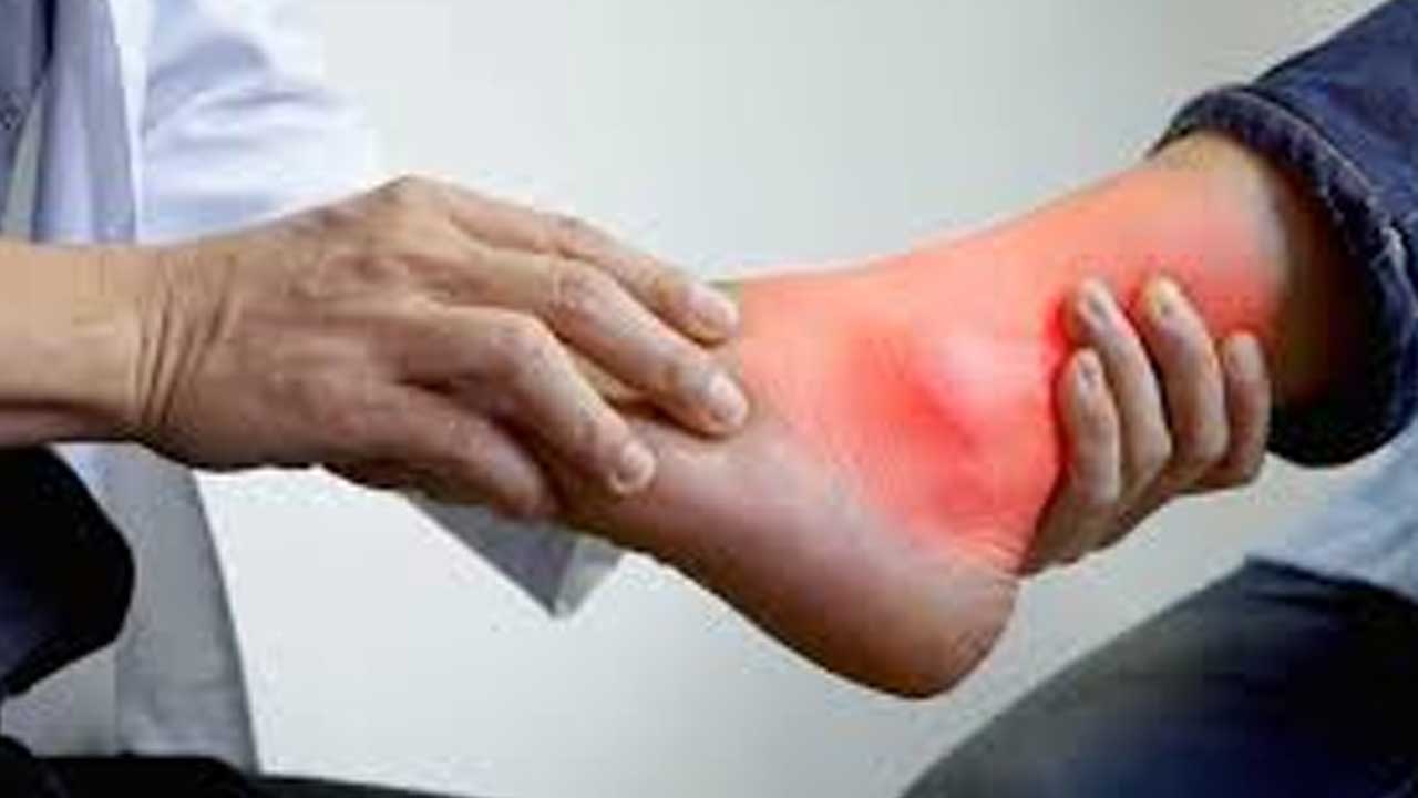 Health tips | శ‌రీరంలో యూరిక్ యాసిడ్ పెరిగితే ప్రమాదం.. నియంత్రణ ఇలా..!