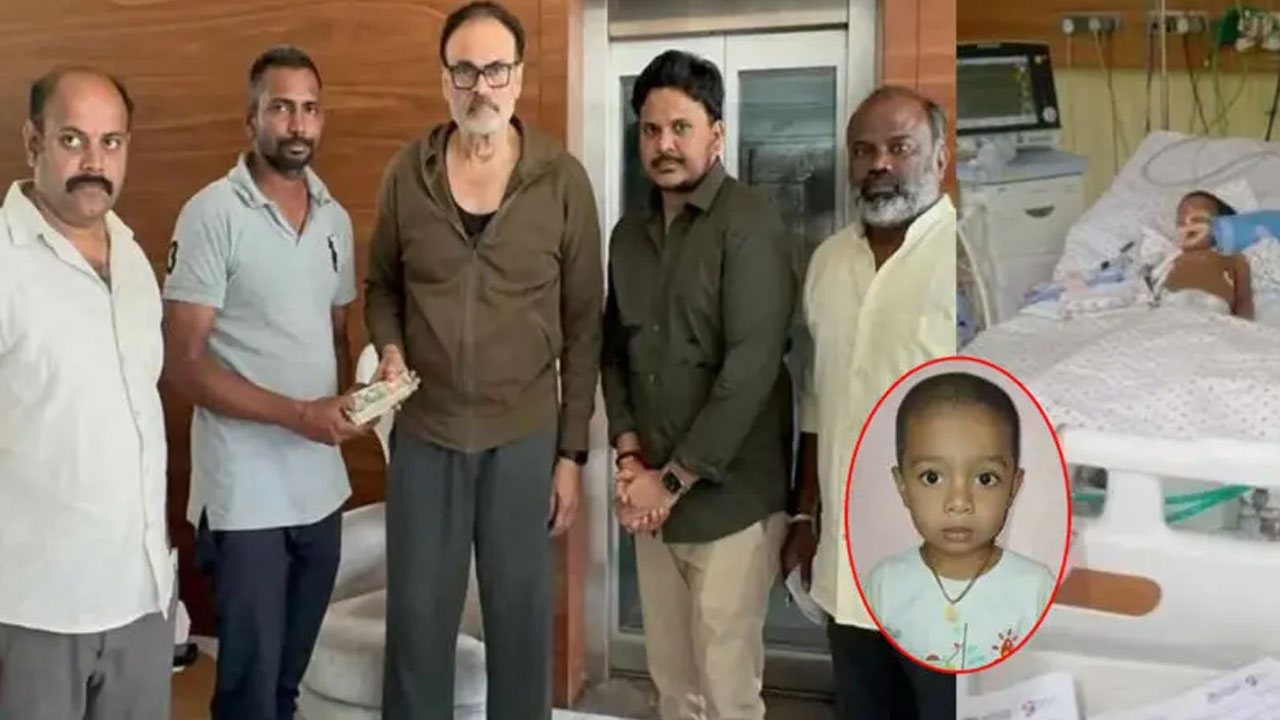 Naga Babu | గుండె సమస్యతో బాధపడుతున్న చిన్నారికి నాగబాబు అండ.. లక్ష రూపాయల ఆర్థిక సహాయం