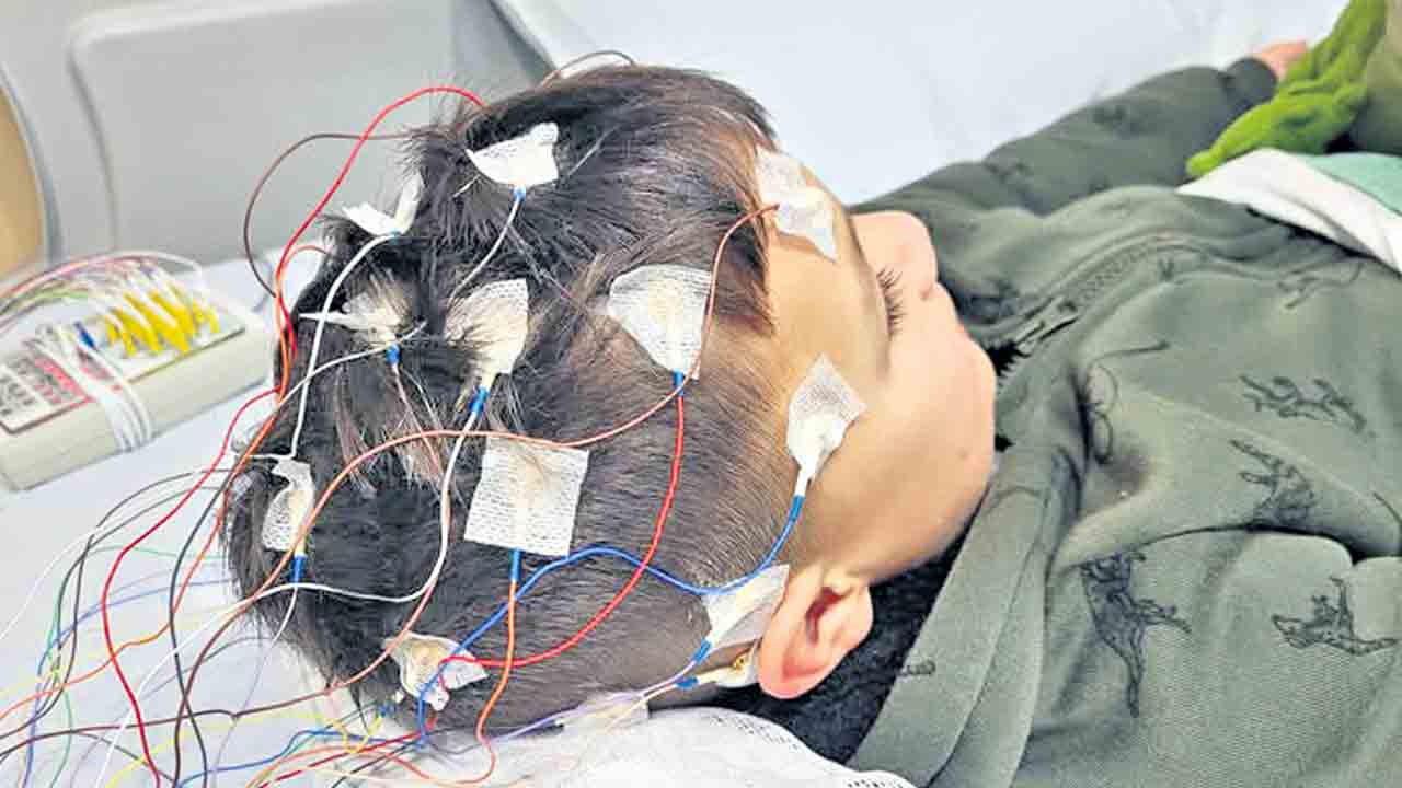 ఫిట్స్‌కి సర్జరీ అవసరమా?