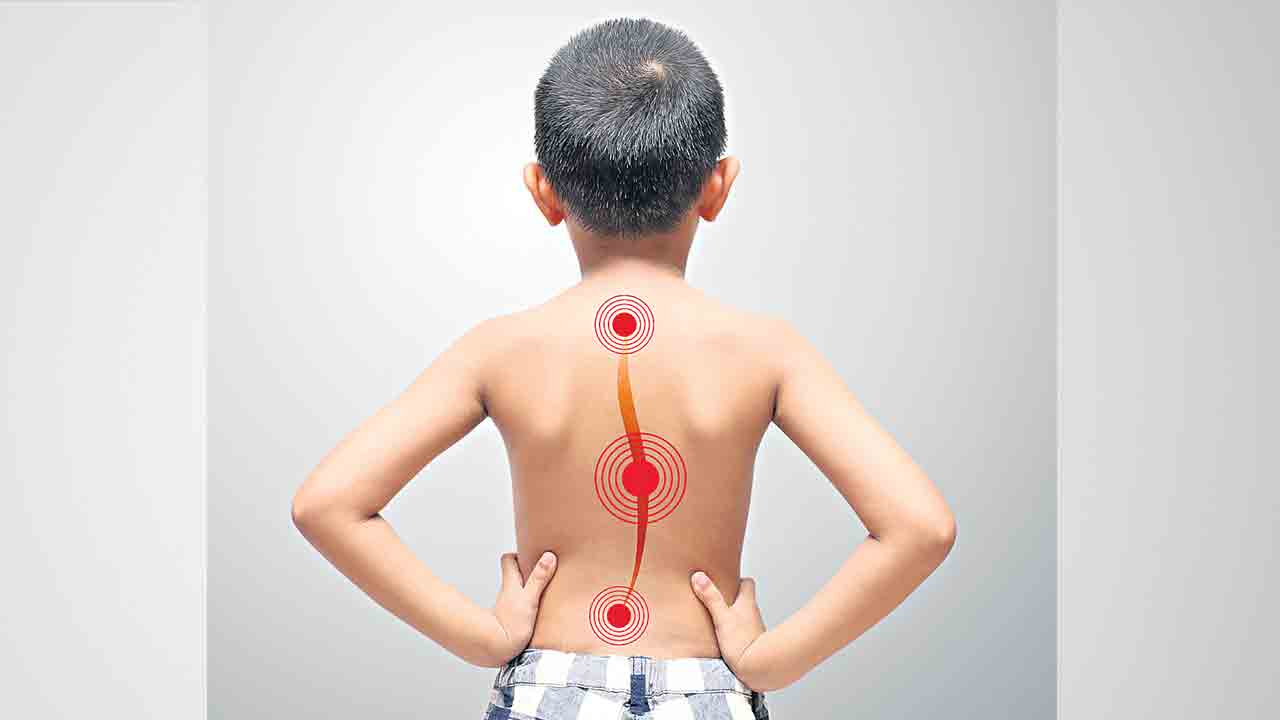 ఎముకలు ఎందుకు వంగిపోతున్నాయి?