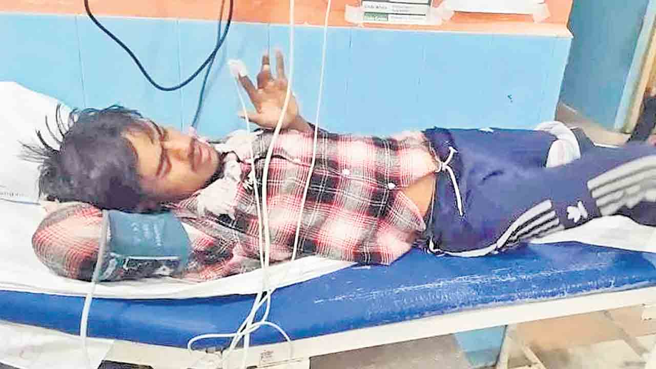 గురుకులంలో విద్యార్థికి పాముకాటు