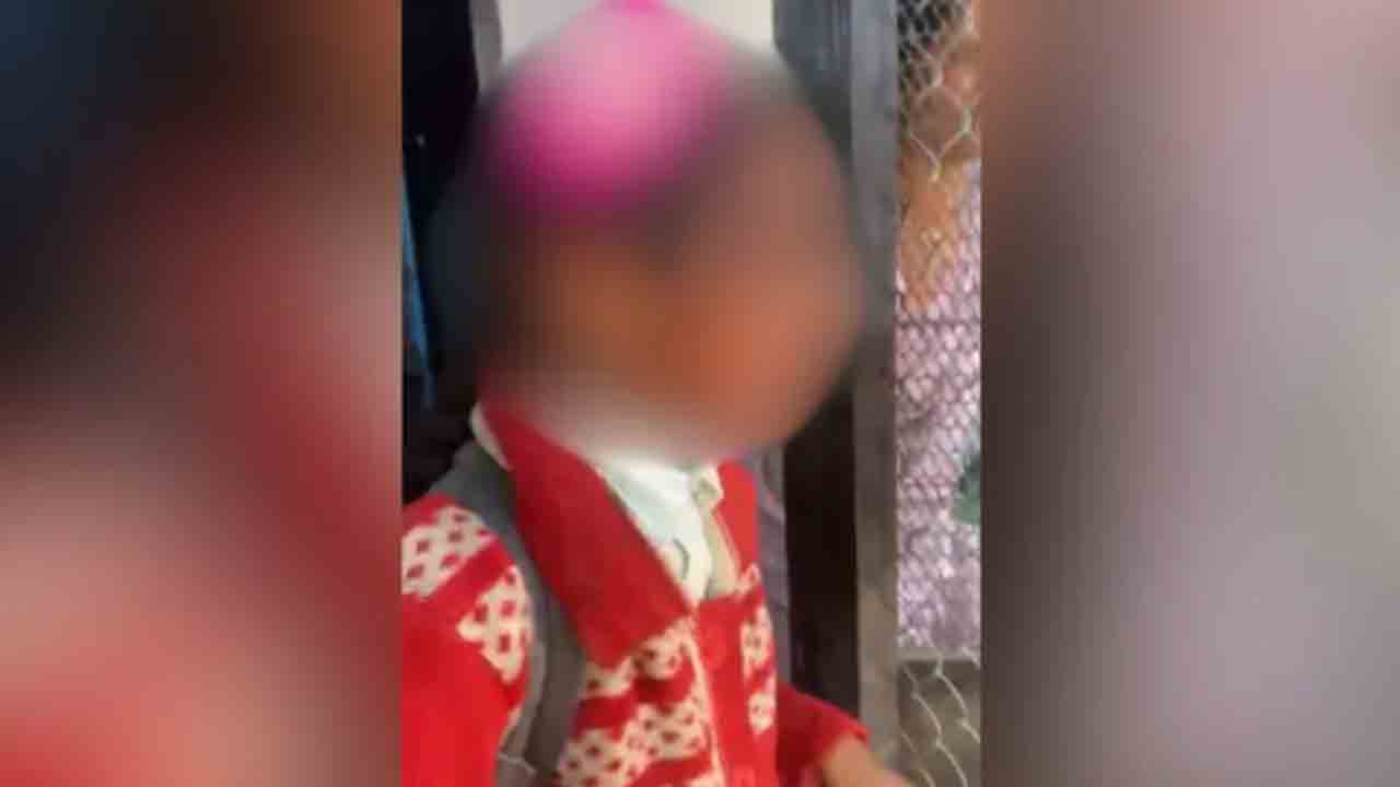 Acid Thrown On School Girl | స్కూల్‌ నుంచి ఇంటికి వెళ్తున్న బాలిక.. ముఖంపై యాసిడ్‌ పోసిన వ్యక్తి