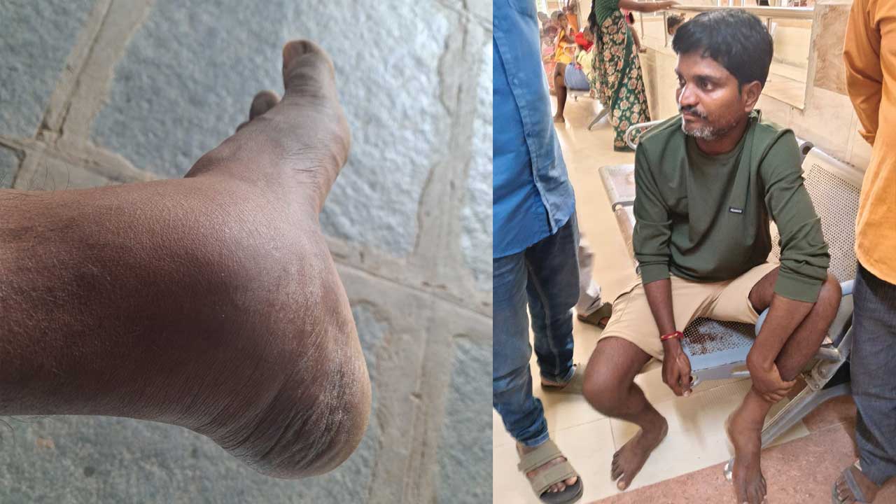 సీఎం ఇలాకాలో.. కాంగ్రెస్‌ అరాచకం