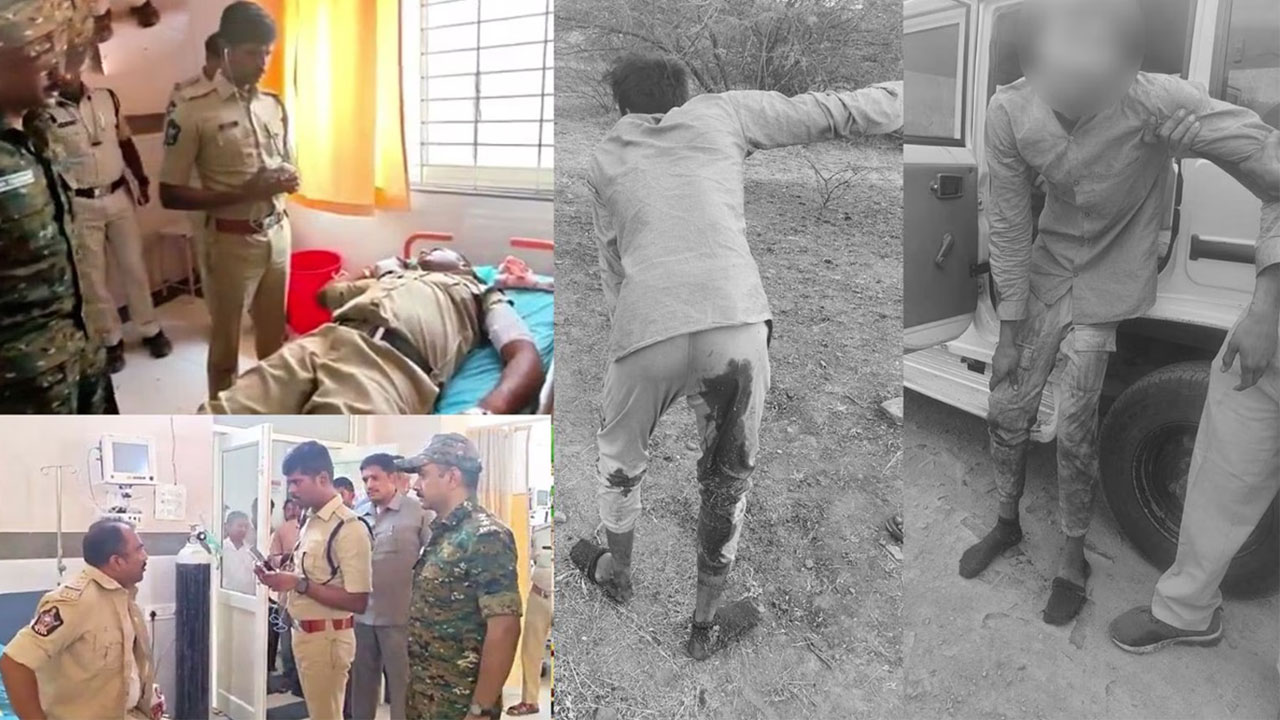 Firing | పోలీసులపై బీరు బాటిల్‌తో దాడి.. కాల్పుల్లో నిందితుడికి గాయాలు