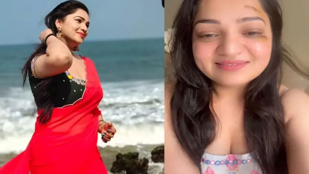 Ashwini Sri | కుక్కను వాకింగ్‌కు తీసుకెళుతూ ప్రమాదం.. గాయాలతో వీడియో షేర్ చేసిన అశ్విని శ్రీ