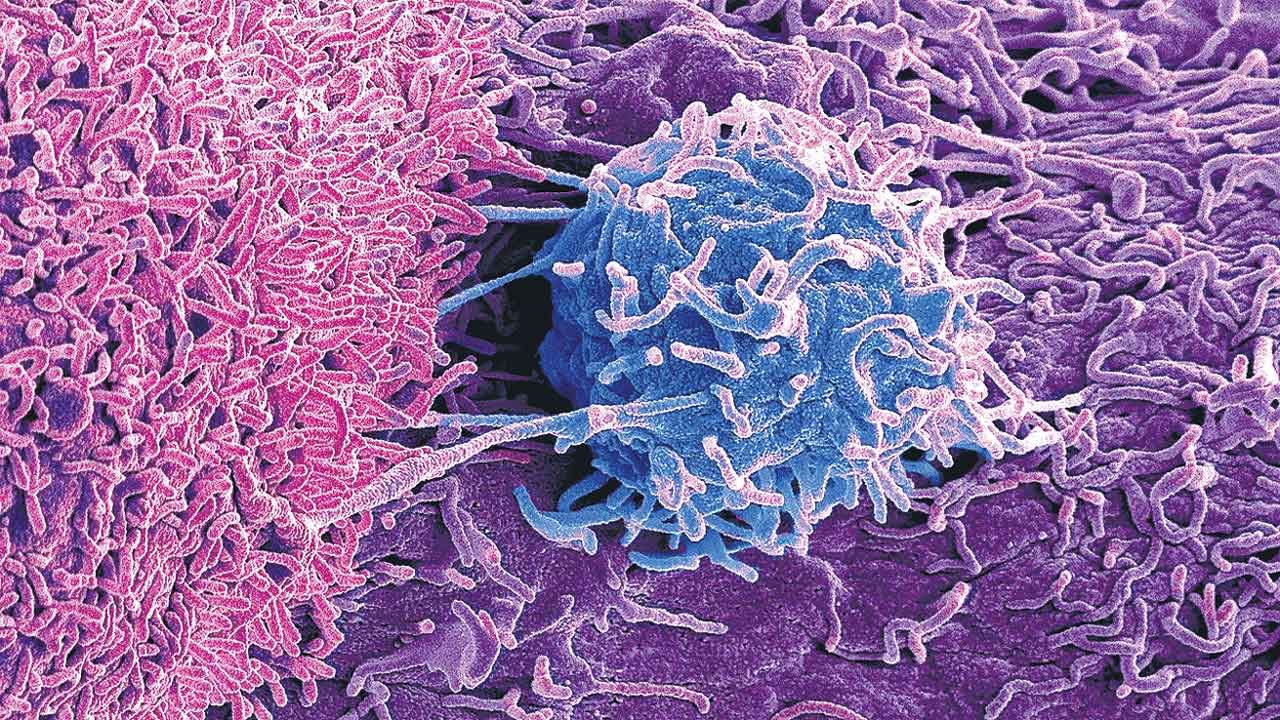 Cancer | బ్యాక్టీరియాతో క్యాన్సర్‌కు చికిత్స!..వాటర్‌లూ పరిశోధకుల కొత్త విధానం