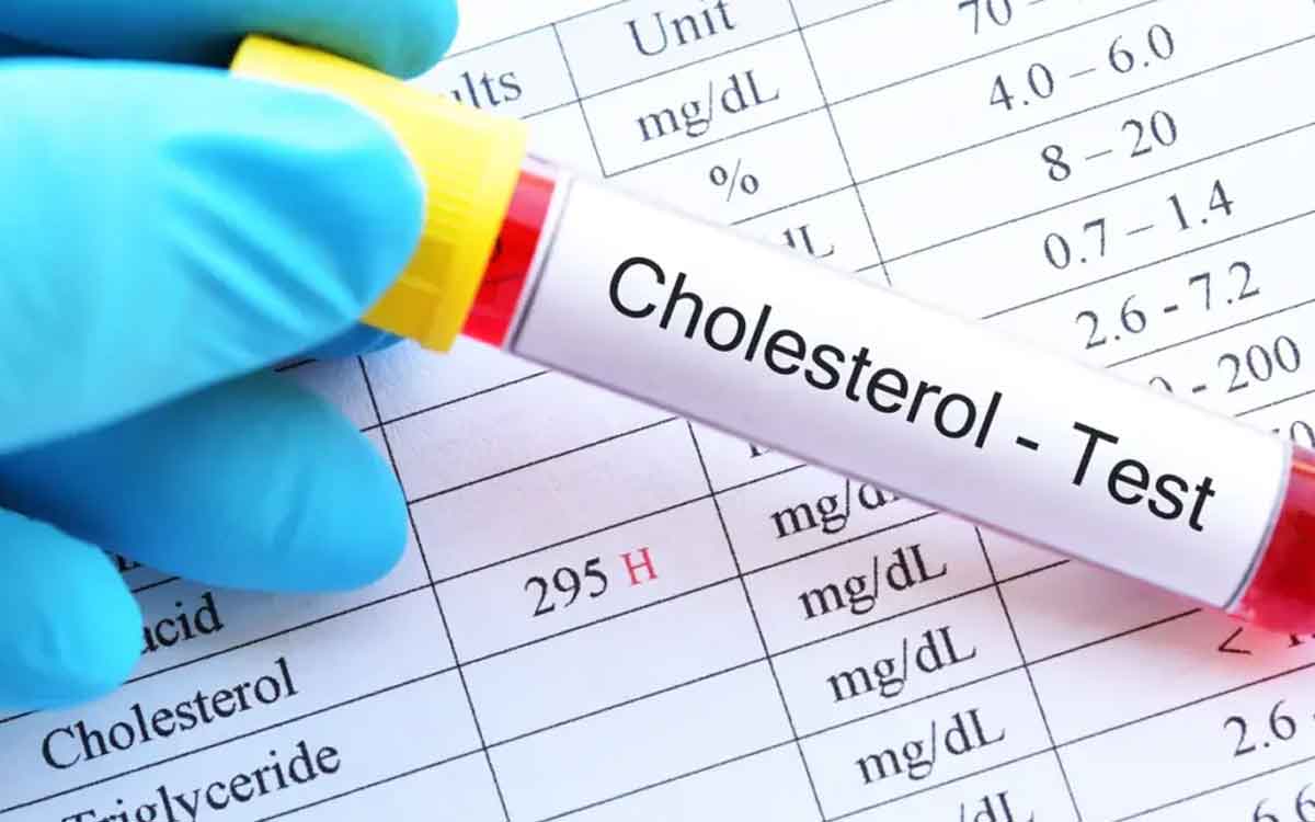 Cholesterol | చెడు కొలెస్ట్రాల్ స్థాయిలు తగ్గి మంచి కొలెస్ట్రాల్ స్థాయిలు పెర‌గాలంటే.. వీటిని తీసుకోవాలి..