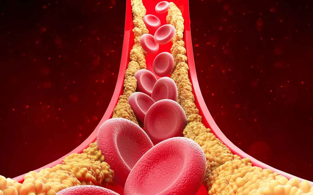Cholesterol Levels | కొలెస్ట్రాల్ స్థాయిలు అధికంగా ఉన్న‌వారు తీసుకోవాల్సిన ఆహారాలు ఇవే..