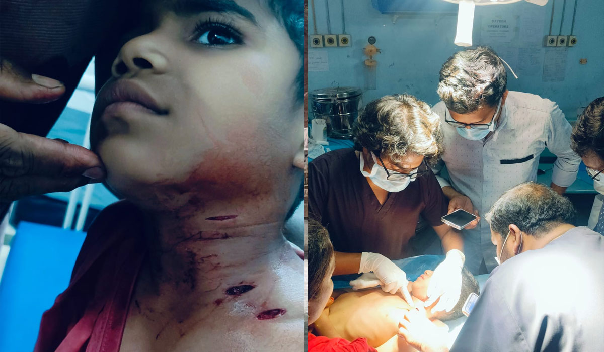 Dog Attack | చిమన్‌పల్లిలో పిచ్చికుక్క దాడి.. పలువురికి గాయాలు