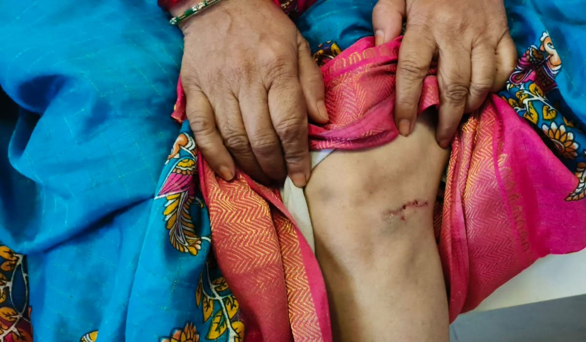 Vemulawada | వేములవాడలో శునకాల స్వైర విహారం.. 35 మందిని గాయపరిచిన గ్రామ సింహాలు