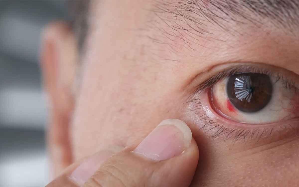 Eyes | క‌ళ్ల‌లో త‌ర‌చూ ఈ ల‌క్ష‌ణాలు క‌నిపిస్తున్నాయా.. అయితే ఏమాత్రం నిర్ల‌క్ష్యం చేయ‌కండి..