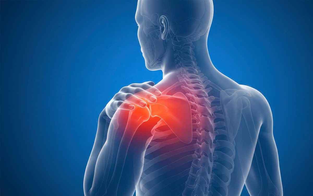 Frozen Shoulder | భుజం బిగుతుగా మారి క‌ద‌లిక‌లు నొప్పిగా ఉన్నాయా.. ఈ ప‌రిస్థితిని ఏమంటారు, ఇది వస్తే ఏం చేయాలి..?