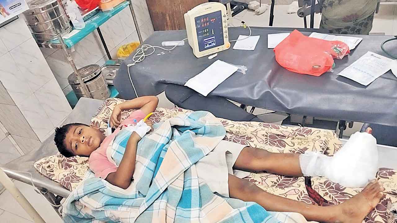 మేడారం గద్దె శిల రాలి బాలుడికి తీవ్రగాయాలు