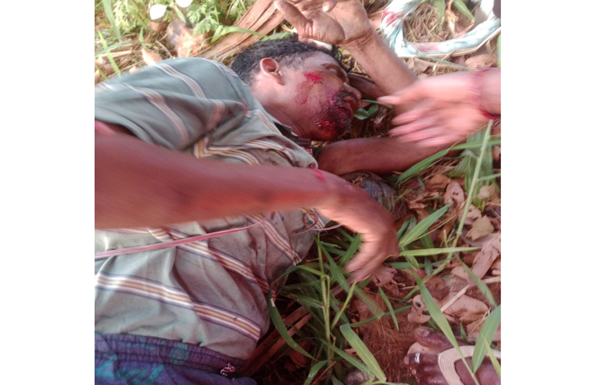 తాటి చెట్టు పై నుండి పడి గీత కార్మికుడికి తీవ్ర గాయాలు