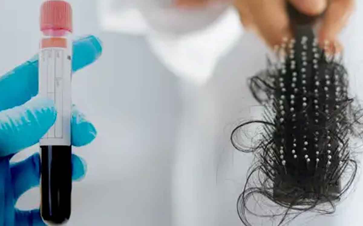 Hair Health Tests | జుట్టు రాలే స‌మ‌స్య ఉన్న‌వారు ఎలాంటి వైద్య ప‌రీక్ష‌ల‌ను చేయించుకోవాలి..?