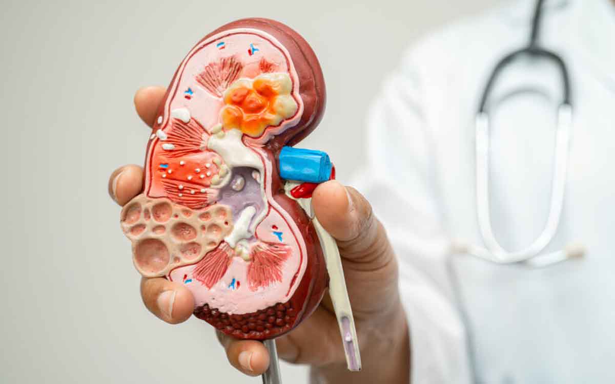 Kidney Diseases | దేశంలో ఏటా పెరిగిపోతున్న కిడ్నీ వ్యాధులు.. 30 ఏళ్ల నుంచే ప‌రీక్ష‌లు త‌ప్ప‌నిసరి అంటున్న నిపుణులు..