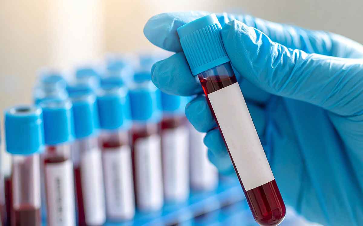 Heart Health | గుండె ఆరోగ్యంగా ఉండాలంటే ఏయే ప‌రీక్ష‌ల‌ను త‌ర‌చూ చేయించుకోవాలి..?