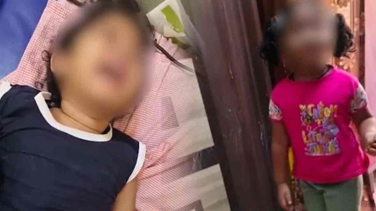 Vijayawada | మూడేళ్ల చిన్నారిపై స్కూల్ టీచర్ యాసిడ్ దాడి.. విజయవాడలో అమానుషం