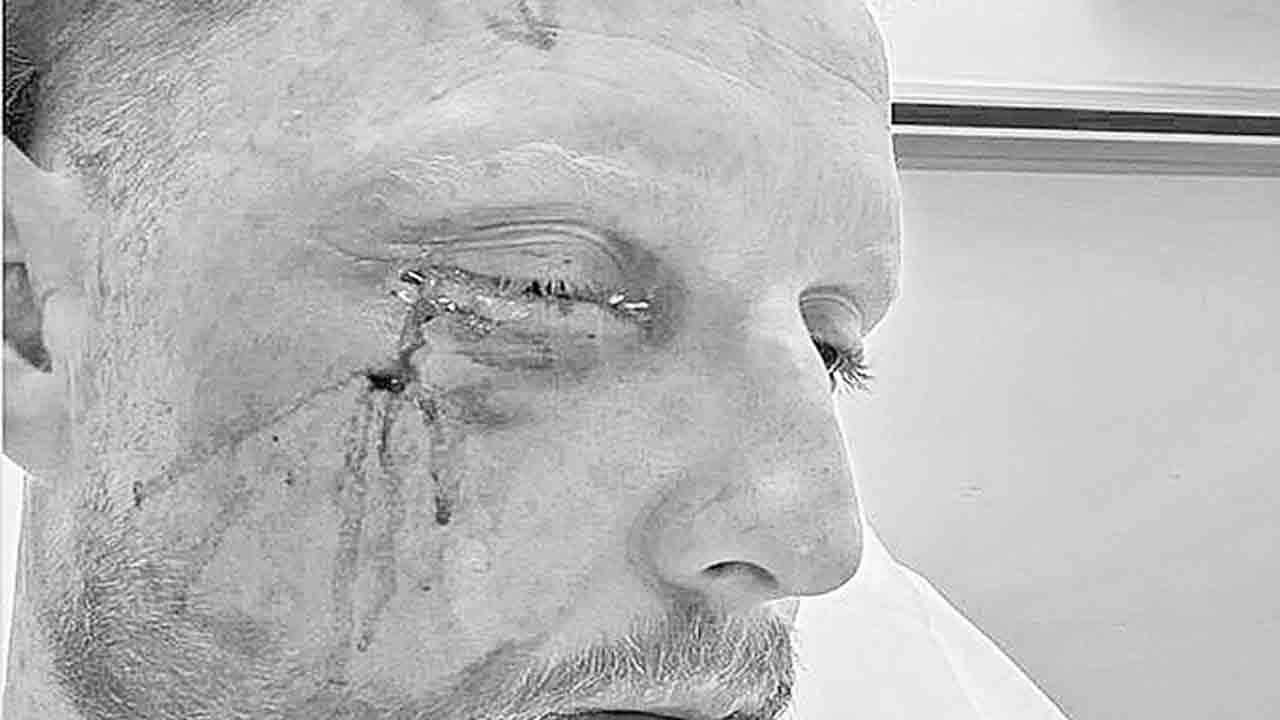 చావు నుంచి తప్పించుకున్నా: స్టోక్స్‌