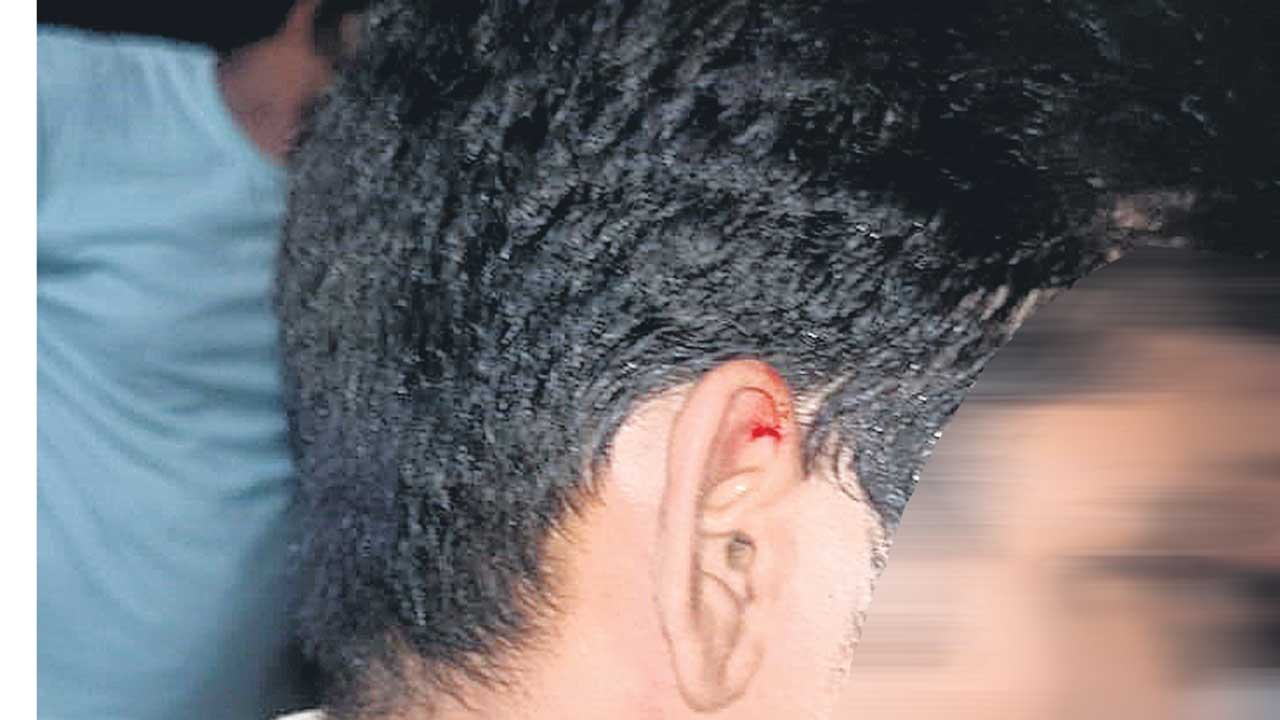 వైద్యకళాశాల విద్యార్థులపై దాడి