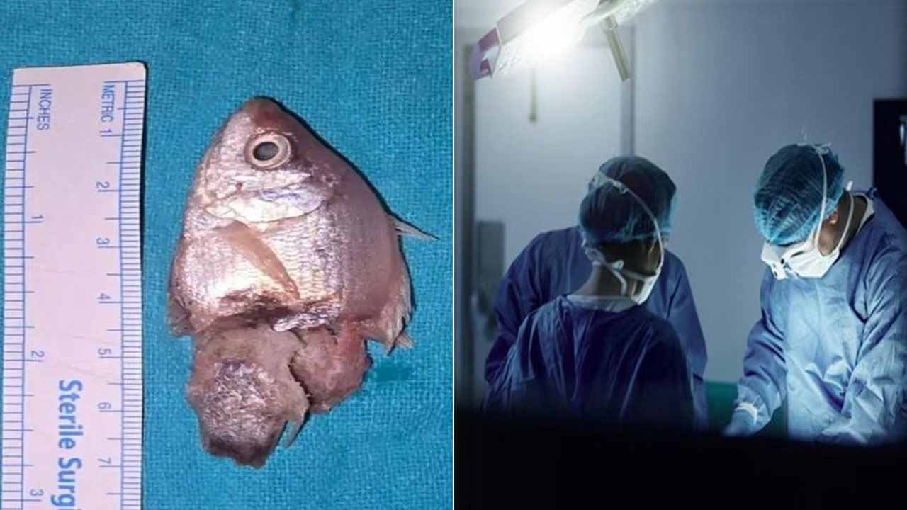 Viral news | చిన్నారి గొంతులో దూరిన ఎక్వేరియం చేప.. తర్వాత ఏం జరిగిందంటే..!