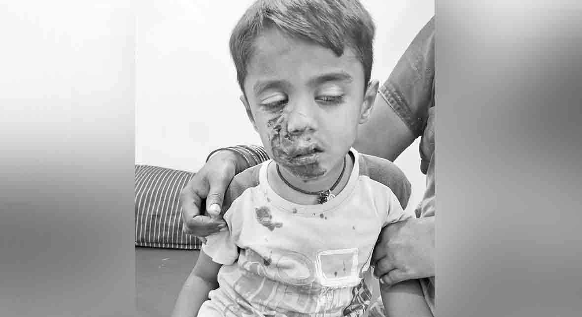 పిచ్చికుక్క స్వైర విహారం.. బాలుడిపై దాడి చేసి గాయపర్చిన ఘటన