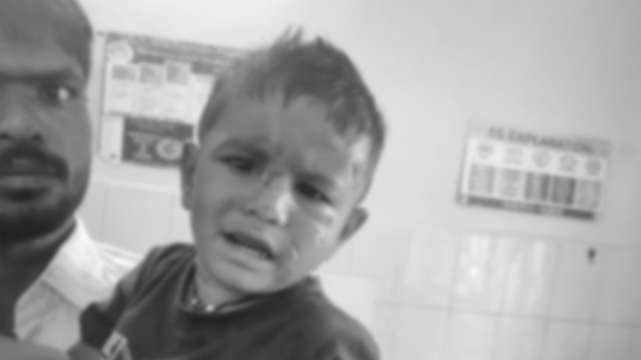 Dogs Attack  | కుక్కల దాడిలో రెండేళ్ల బాలుడికి గాయాలు