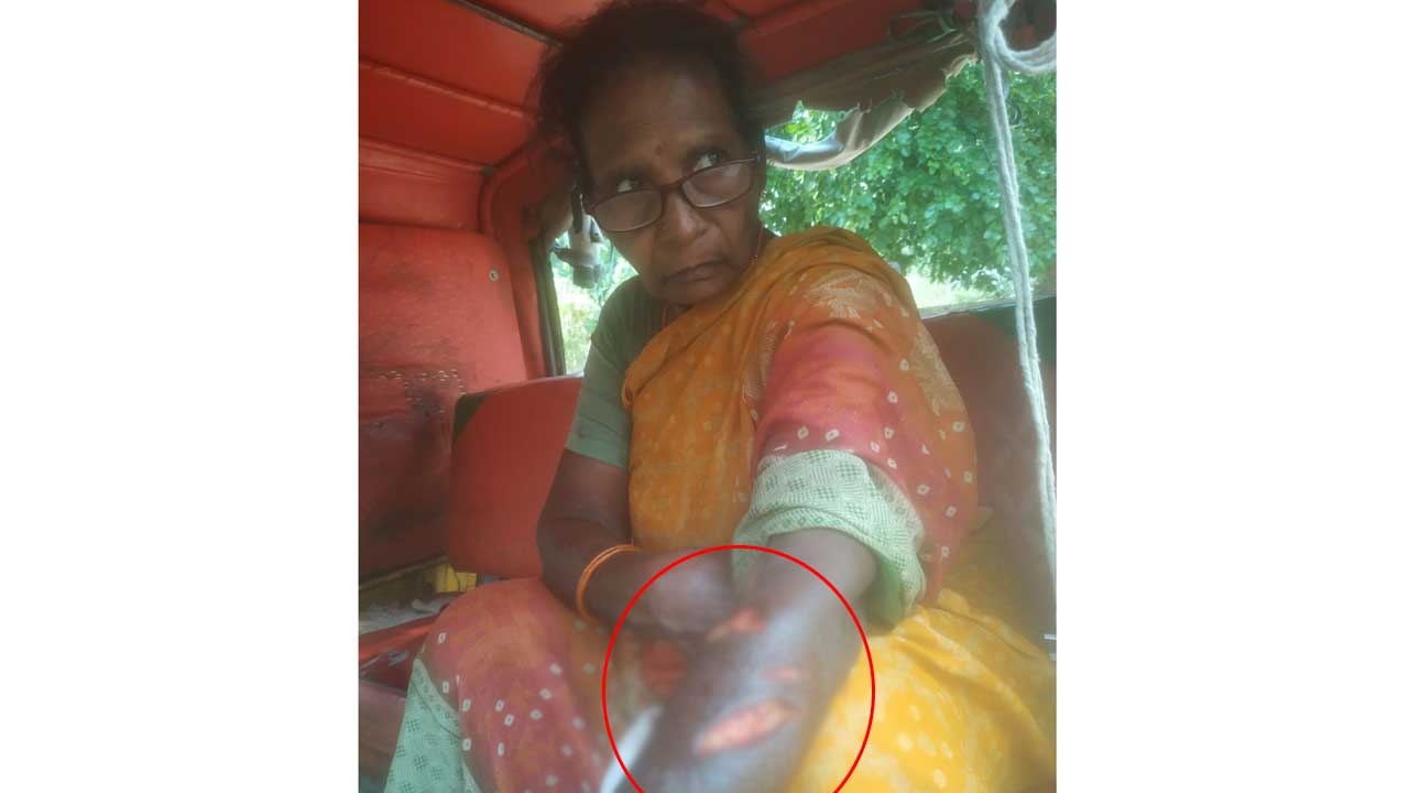 పిచ్చికుక్కల స్వైరవిహారం