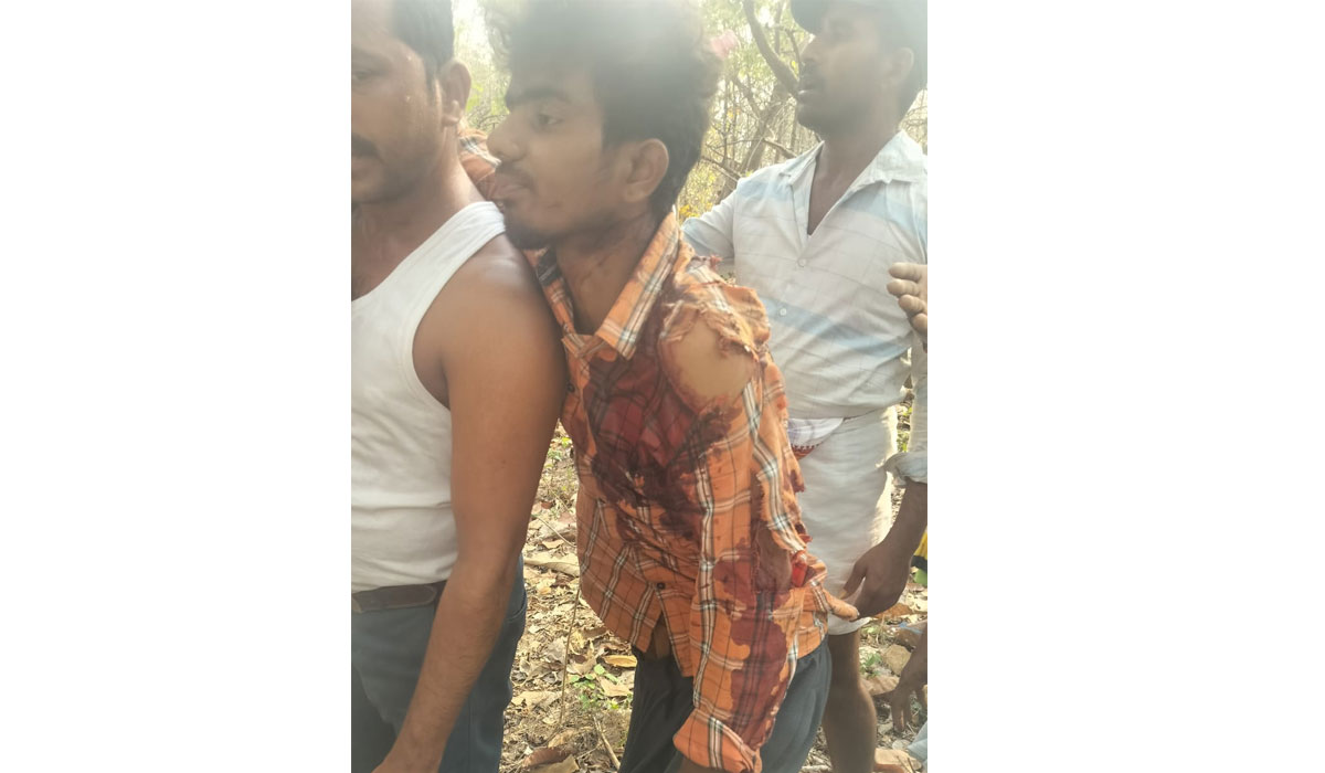 Bear Attack | ఎలుగుబంటి దాడిలో యువకుడికి గాయాలు.. లొంకతండాలో ఘటన