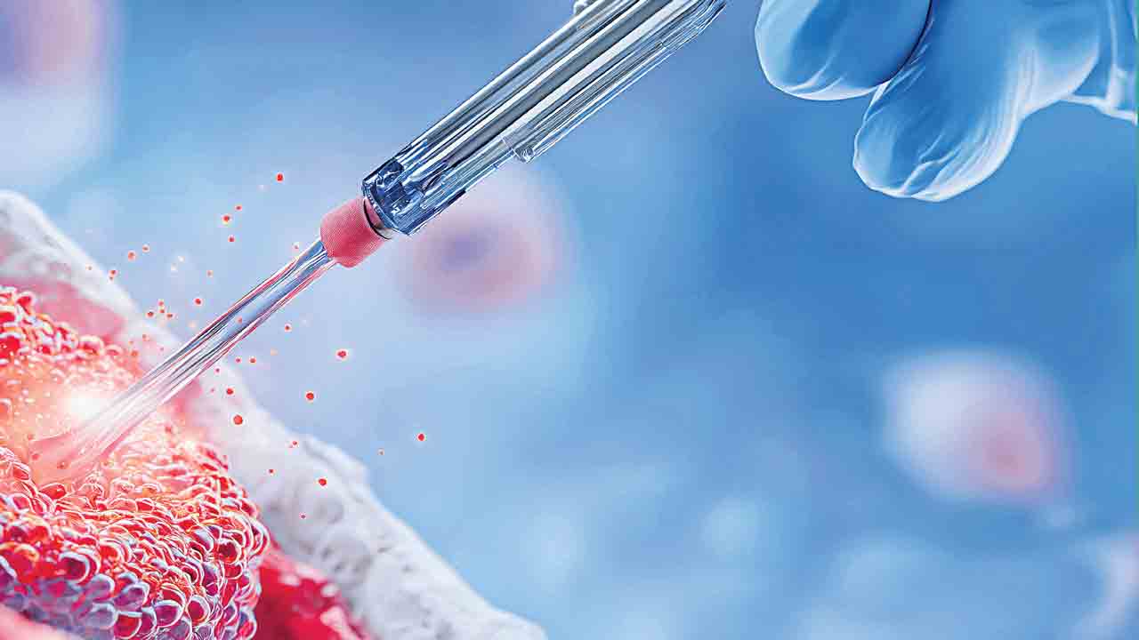 మూలకణ చికిత్స మరింత తేలిక