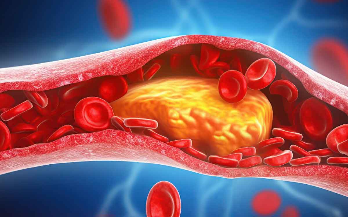 Cholesterol Levels | కొలెస్ట్రాల్ లెవ‌ల్స్‌ను త‌గ్గించ‌డంలో వీటిలో ఏది స‌మ‌ర్థ‌వంతంగా ప‌నిచేస్తుంది..?