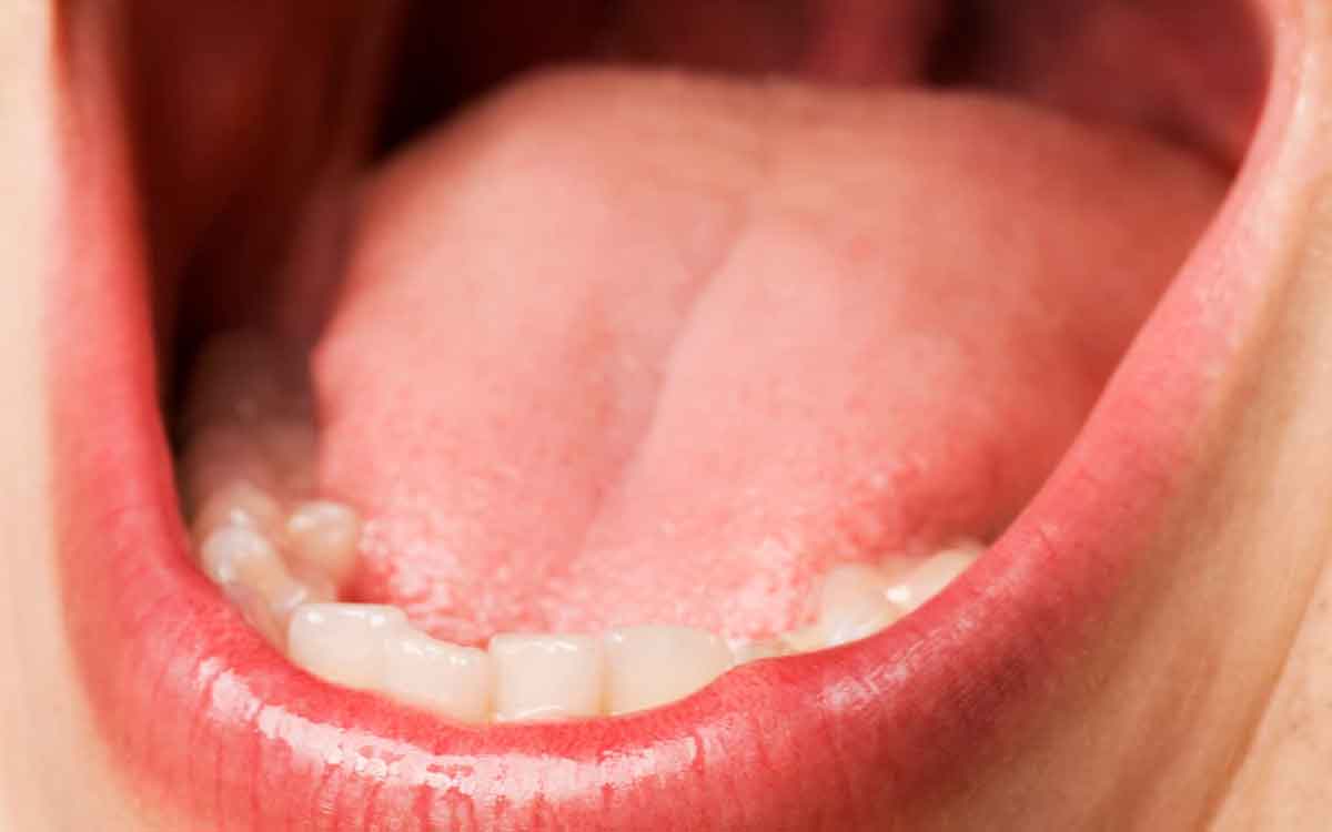 Dry Mouth | వేస‌విలో నోటి స‌మ‌స్య‌లు వ‌చ్చేందుకు కార‌ణాలు ఇవే.. ఏం చేయాలంటే..