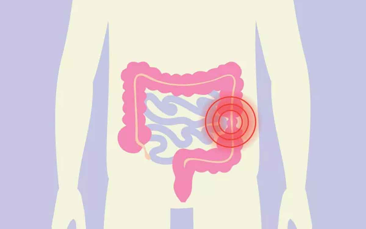 IBS | ఐబీఎస్ స‌మస్య ఉన్న‌వారు ఈ ఆహారాల‌ను తీసుకోవాలి.. జీర్ణ వ్య‌వ‌స్థ‌కు మేలు చేస్తాయి..