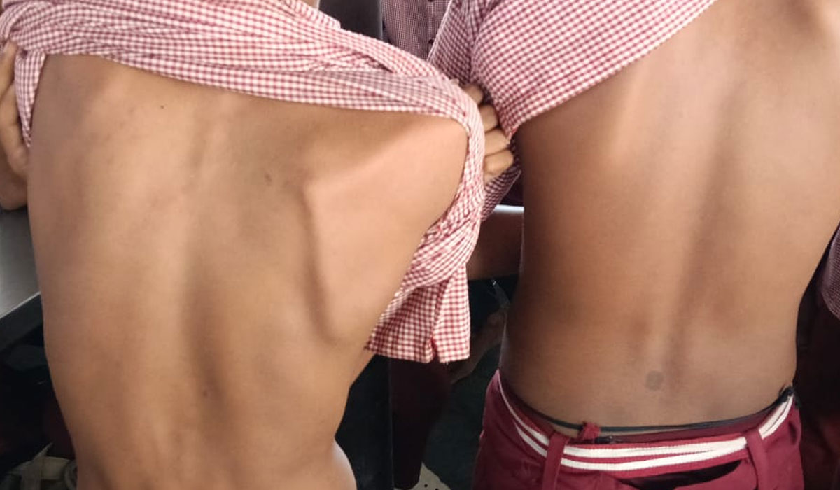 Raging | గంగాధర బీసీ గురుకుల పాఠశాలలో రాగింగ్ భూతం.. తొమ్మిదో తరగతి విద్యార్థులను చితకబాదిన పదో తరగతి విద్యార్థులు