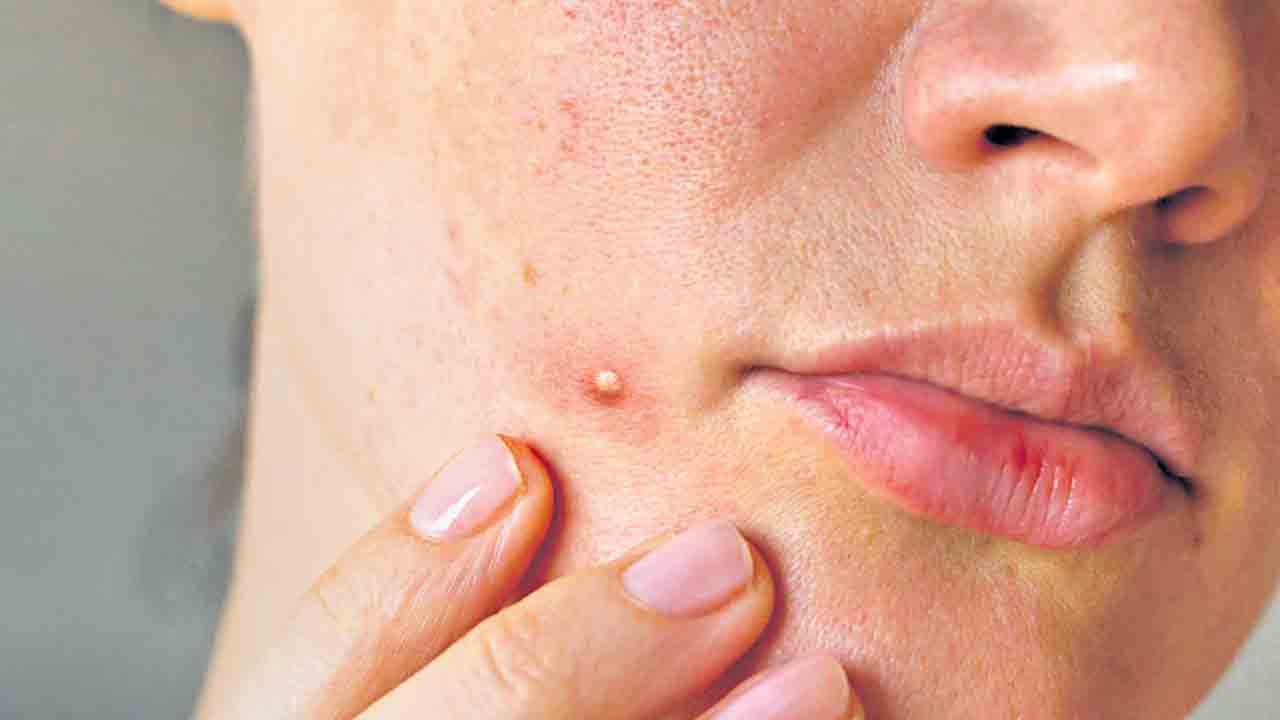 సెగ తగ్గేదెట్లా?