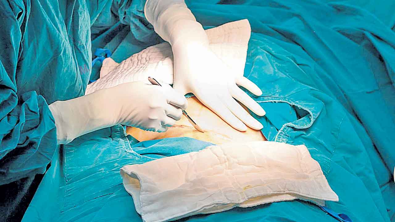 కడుపు‘కోత’ల్లో టాప్‌