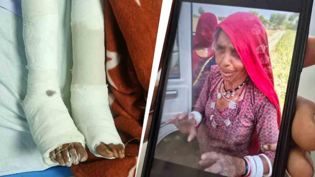doctor operates on wrong leg | ఒక కాలు బదులు మరో కాలుకు ఆపరేషన్‌.. డాక్టర్‌పై చర్యలు