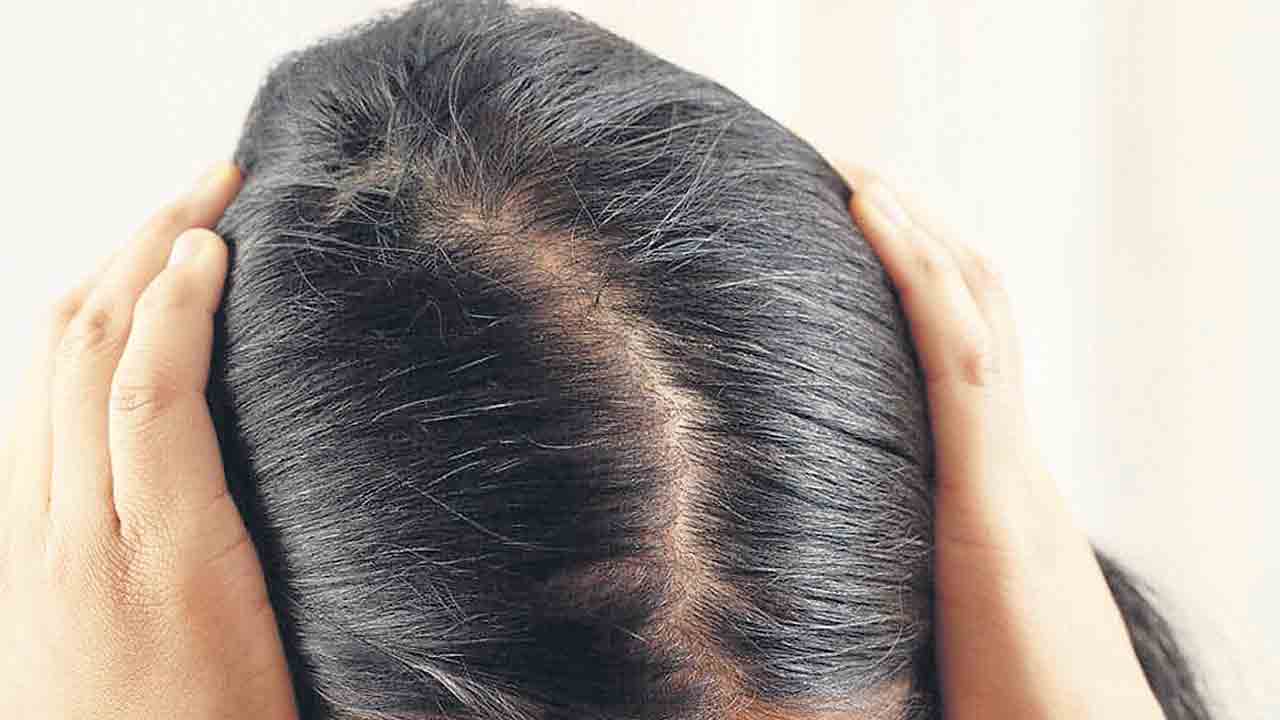 జుట్టుకు జలగండం