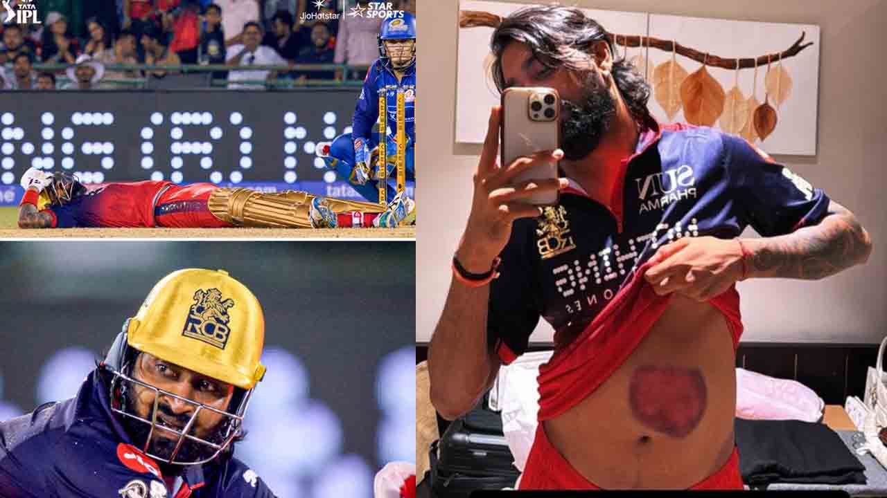 Krunal Pandya | విజయం మిగిల్చిన మచ్చ.. నా పోరాటానికి సాక్ష్యమిదిగో..!