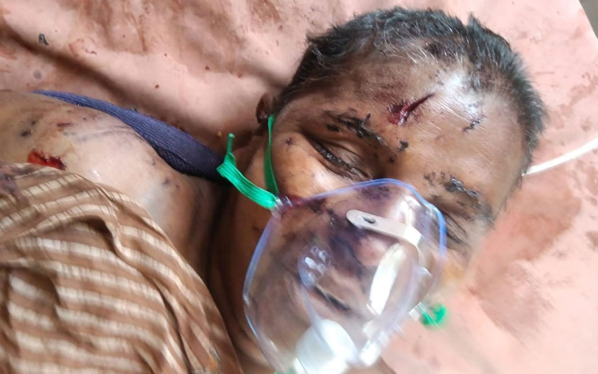 వీధి కుక్కల దాడిలో మహిళ మృతి