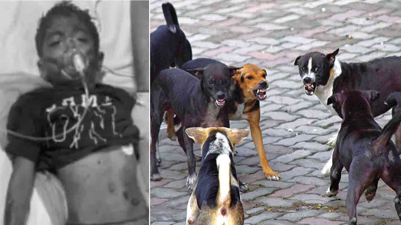 Street Dogs | హైదరాబాద్‌లో దారుణం.. బాలుడిపై దాడి చేసిన 10 వీధికుక్కలు