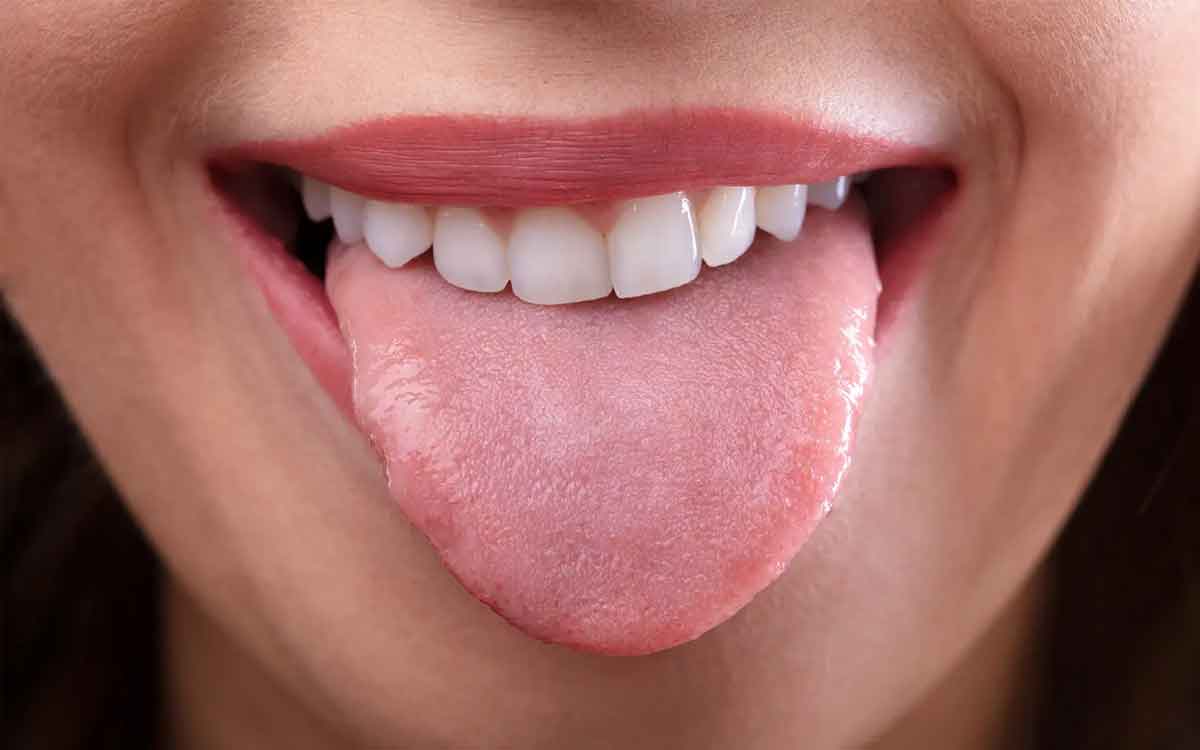 Tongue Color | నాలుక‌పై క‌నిపించే రంగు, మ‌చ్చ‌ల‌ను బ‌ట్టి ఎలాంటి వ్యాధులు ఉన్నాయో ఇలా చెప్ప‌వ‌చ్చు