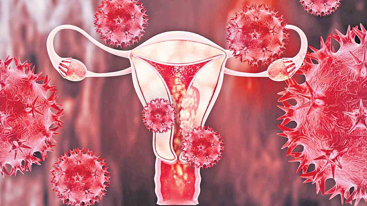 టీకాతో రక్ష.. సర్వైకల్‌ క్యాన్సర్‌ నివారణకు వ్యాక్సిన్‌ సరైన పరిష్కారం