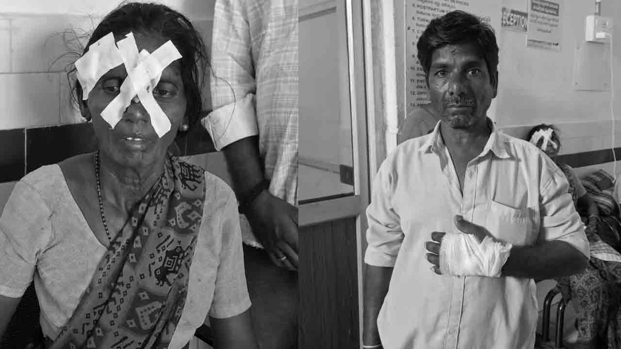 Dog Rampage | పిచ్చికుక్కల స్వైర విహారం.. ఆరుగురికి గాయాలు