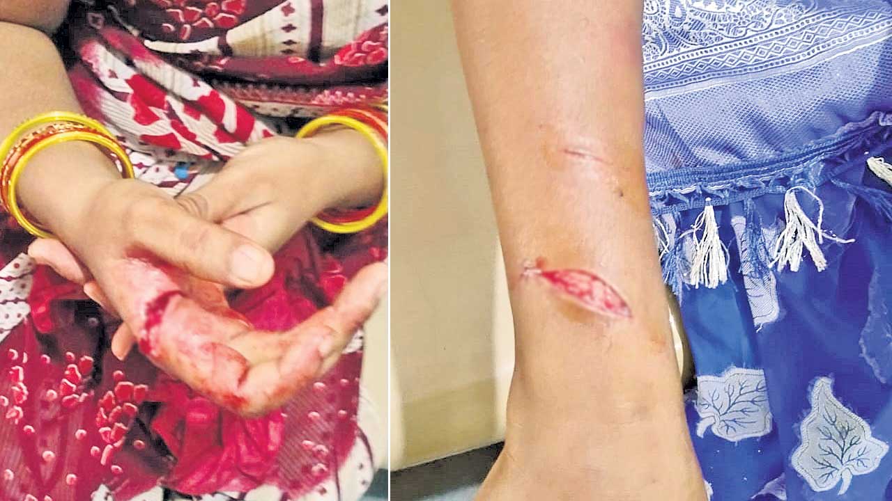 బ్లేడ్‌తో ఇద్దరిపై మహిళ దాడి